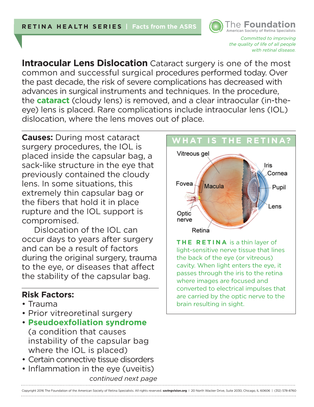 Intraocular Lens Dislocation Cataract Surgery Is One of the Most Common and Successful Surgical Pro­Cedures Performed Today