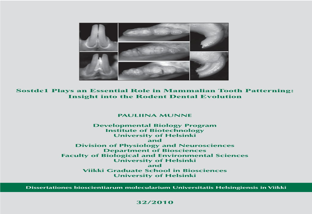 Sostdc1 Plays an Essential Role in Mammalian Tooth Patterning: Tooth Sostdc1 Plays an Essential Role in Mammalian