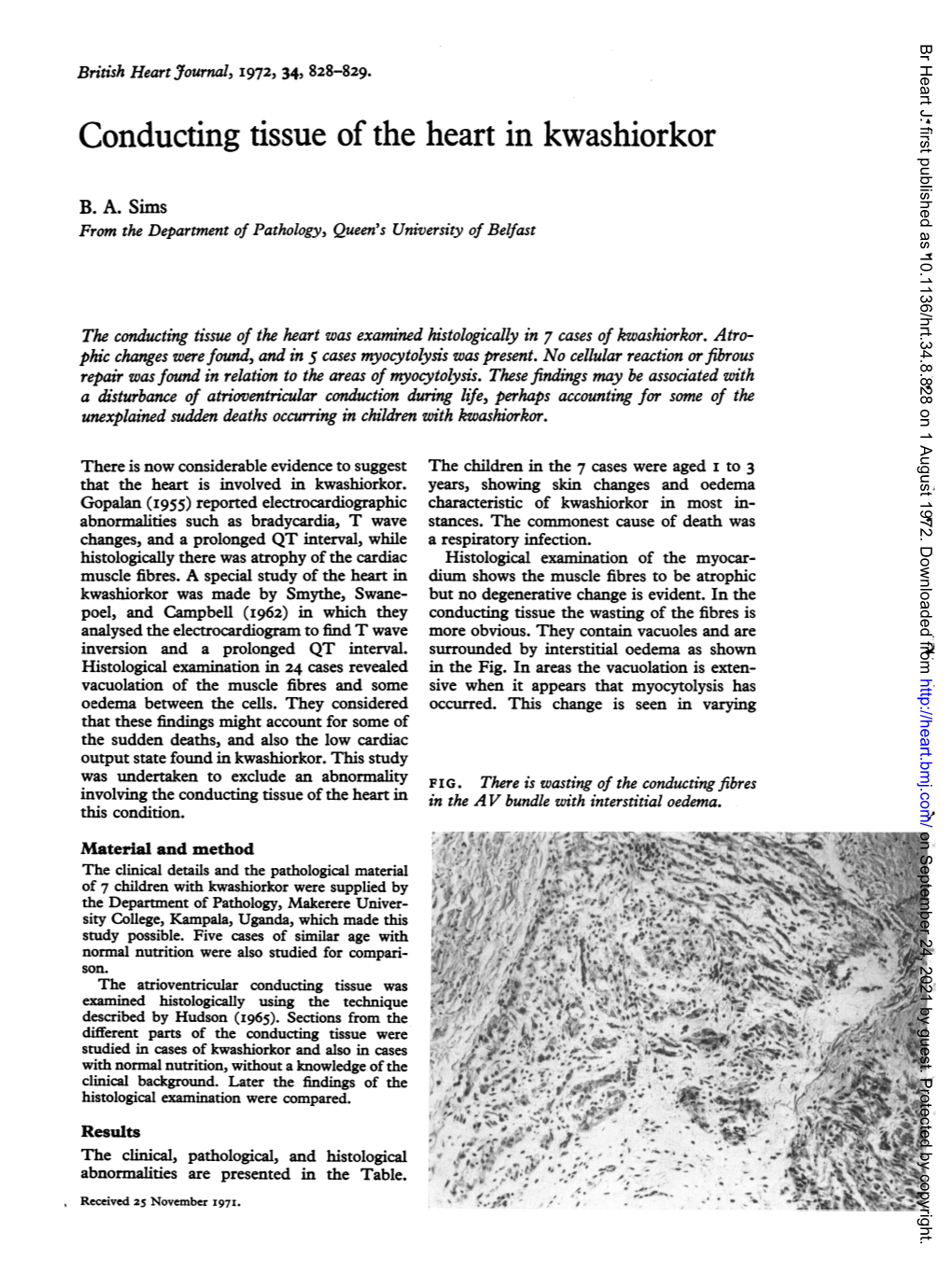 Conducting Tissue of the Heart in Kwashiorkor