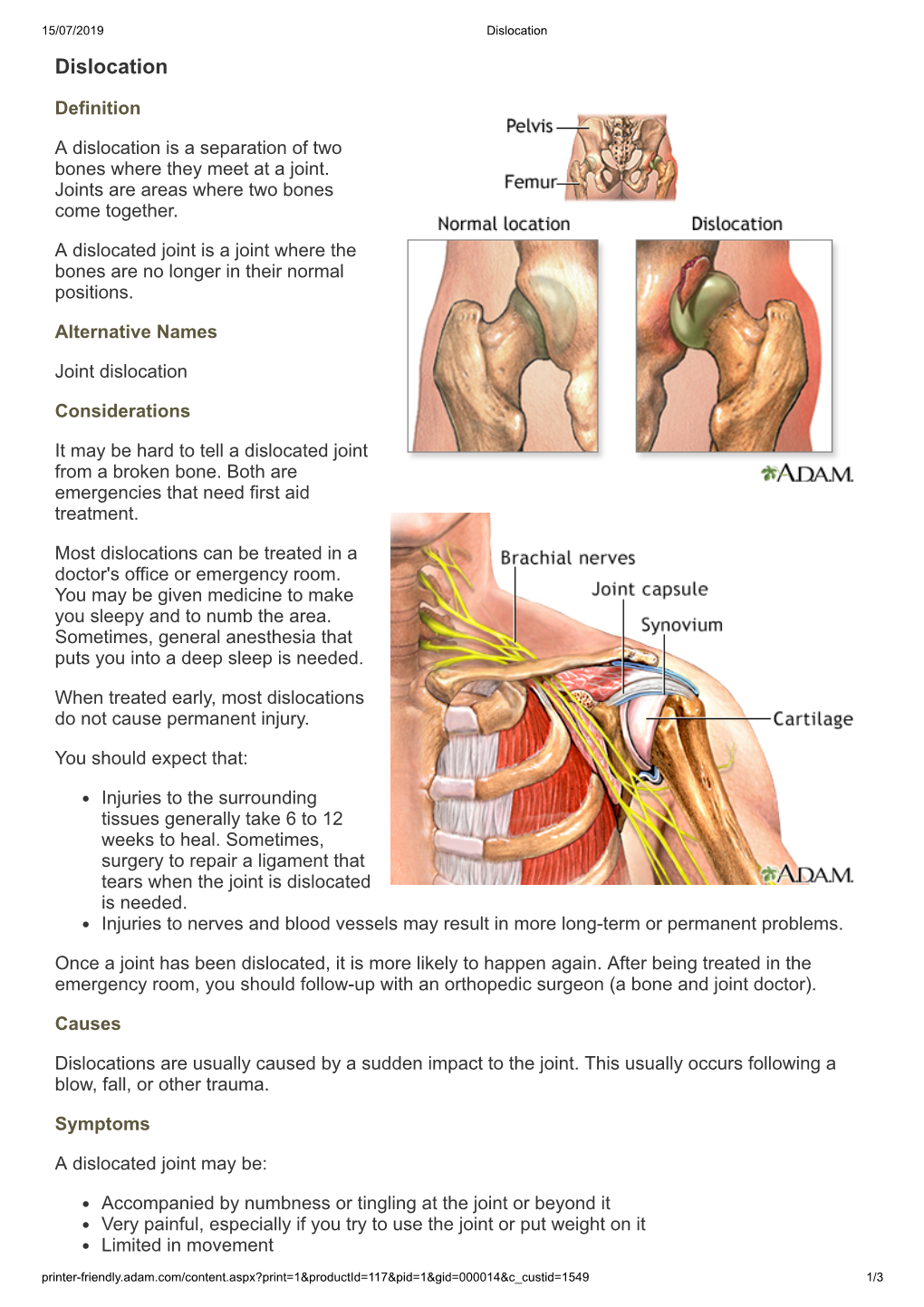 Dislocation Dislocation