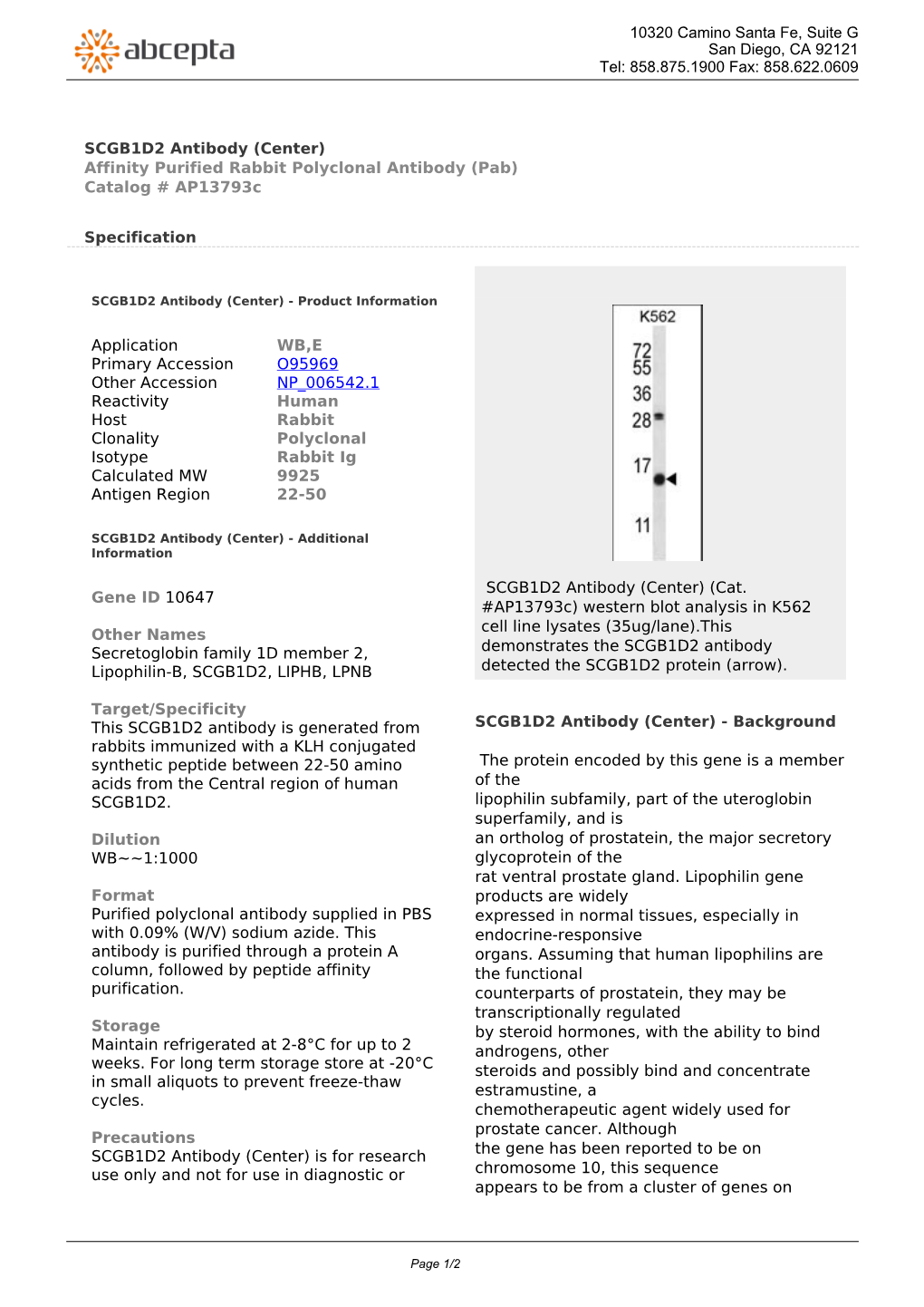 SCGB1D2 Antibody (Center) Affinity Purified Rabbit Polyclonal Antibody (Pab) Catalog # Ap13793c