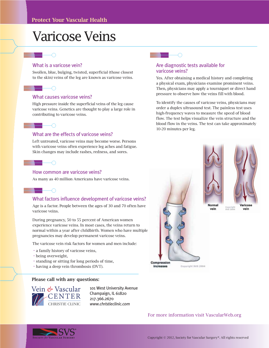 Varicose Veins