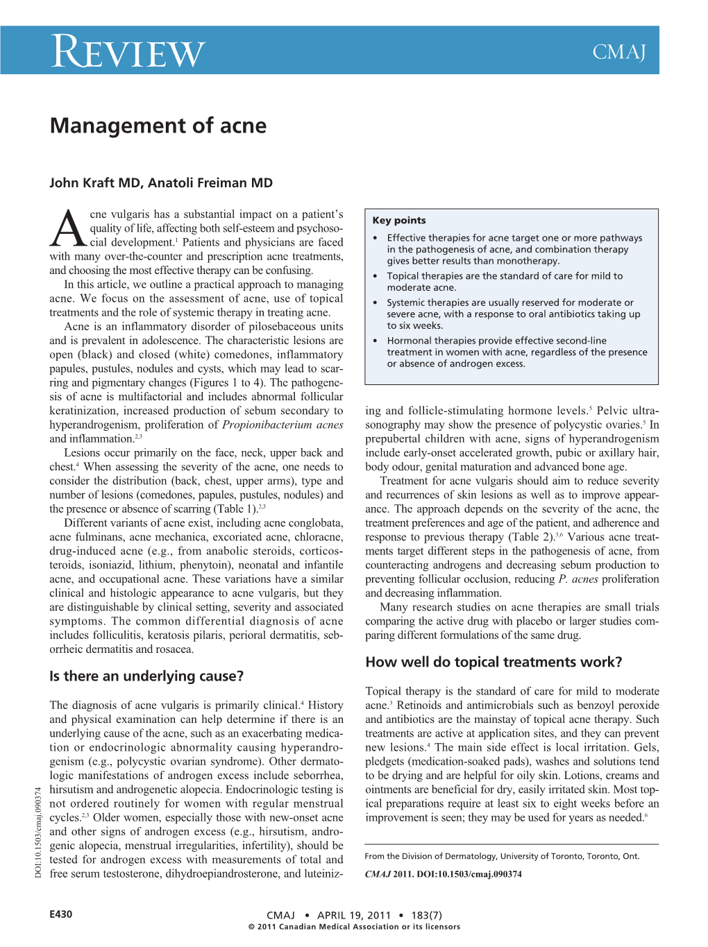 Management of Acne