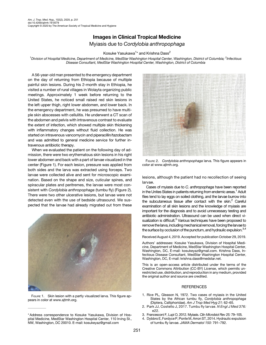 Images in Clinical Tropical Medicine Myiasis Due to Cordylobia Anthropophaga