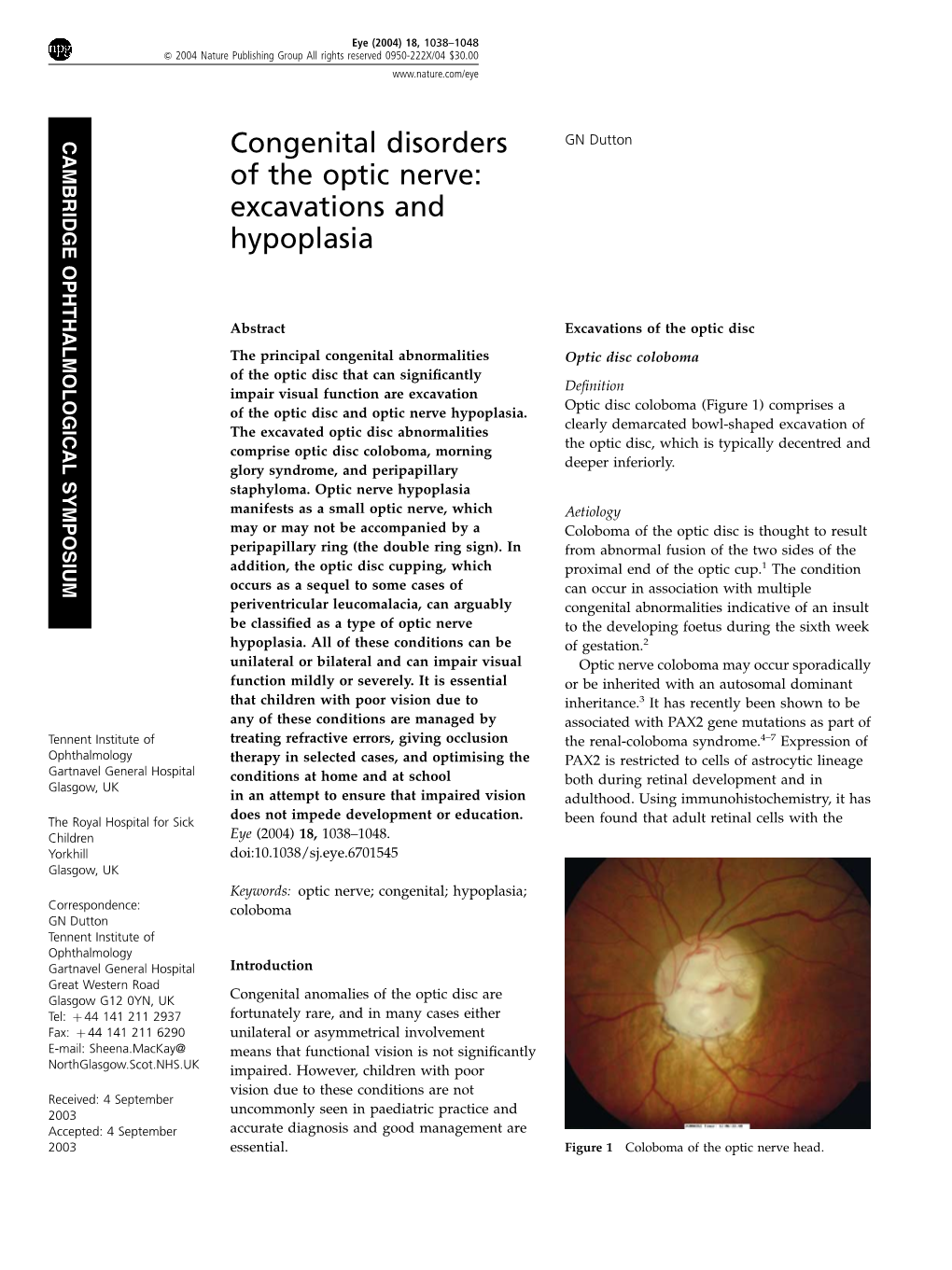 Congenital Disorders of the Optic Nerve GN Dutton 1039