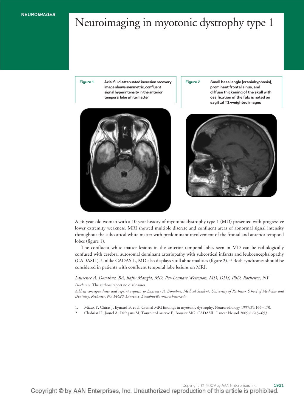 Neuroimaging in Myotonic Dystrophy Type 1