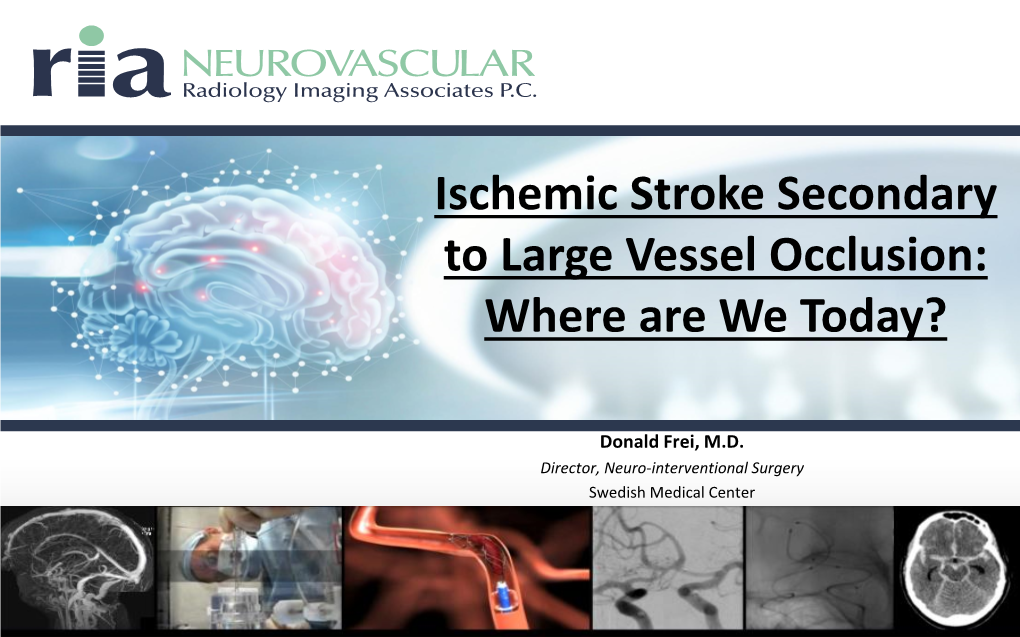 Ischemic Stroke Secondary to Large Vessel Occlusion: Where Are We Today?