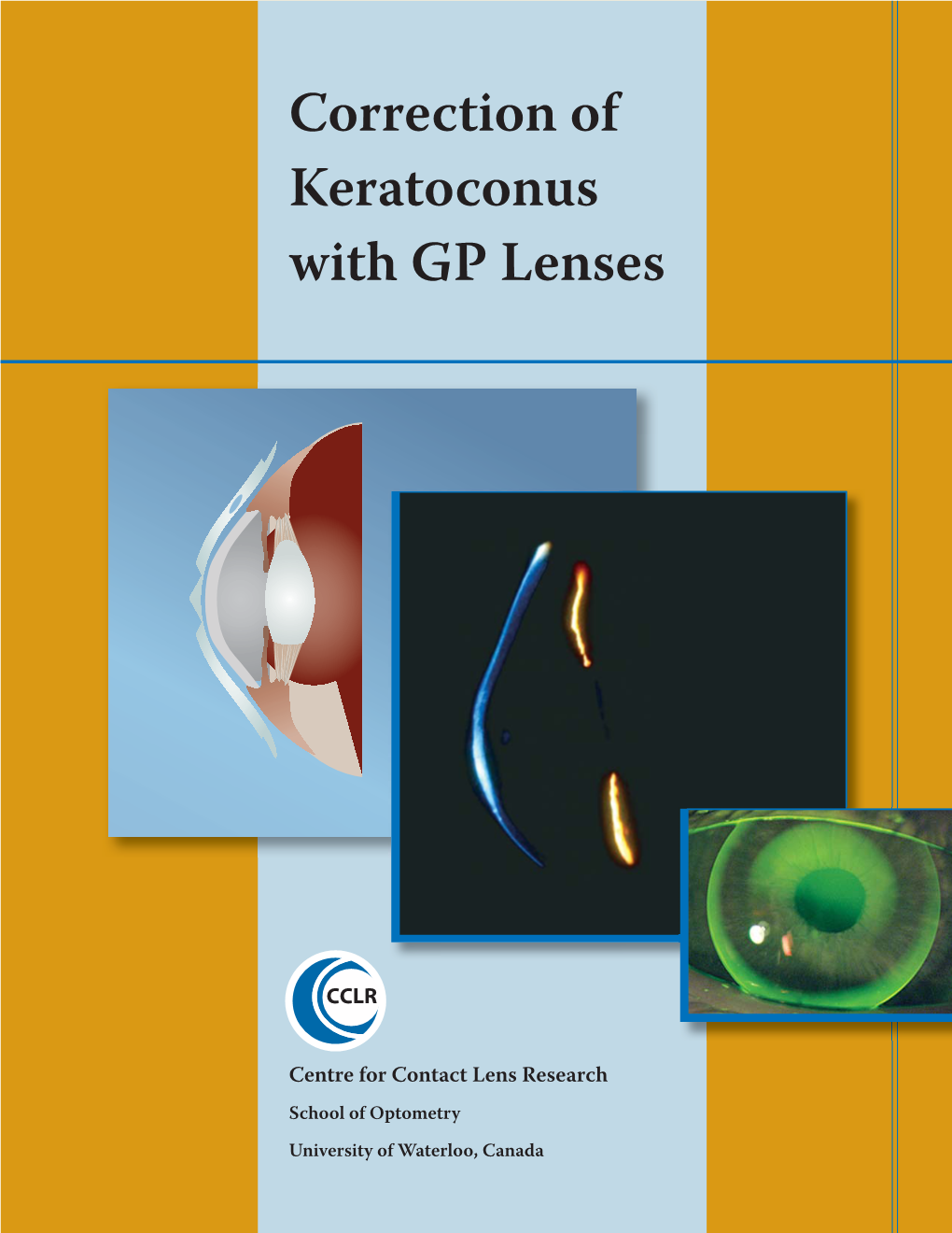 Correction of Keratoconus with GP Lenses