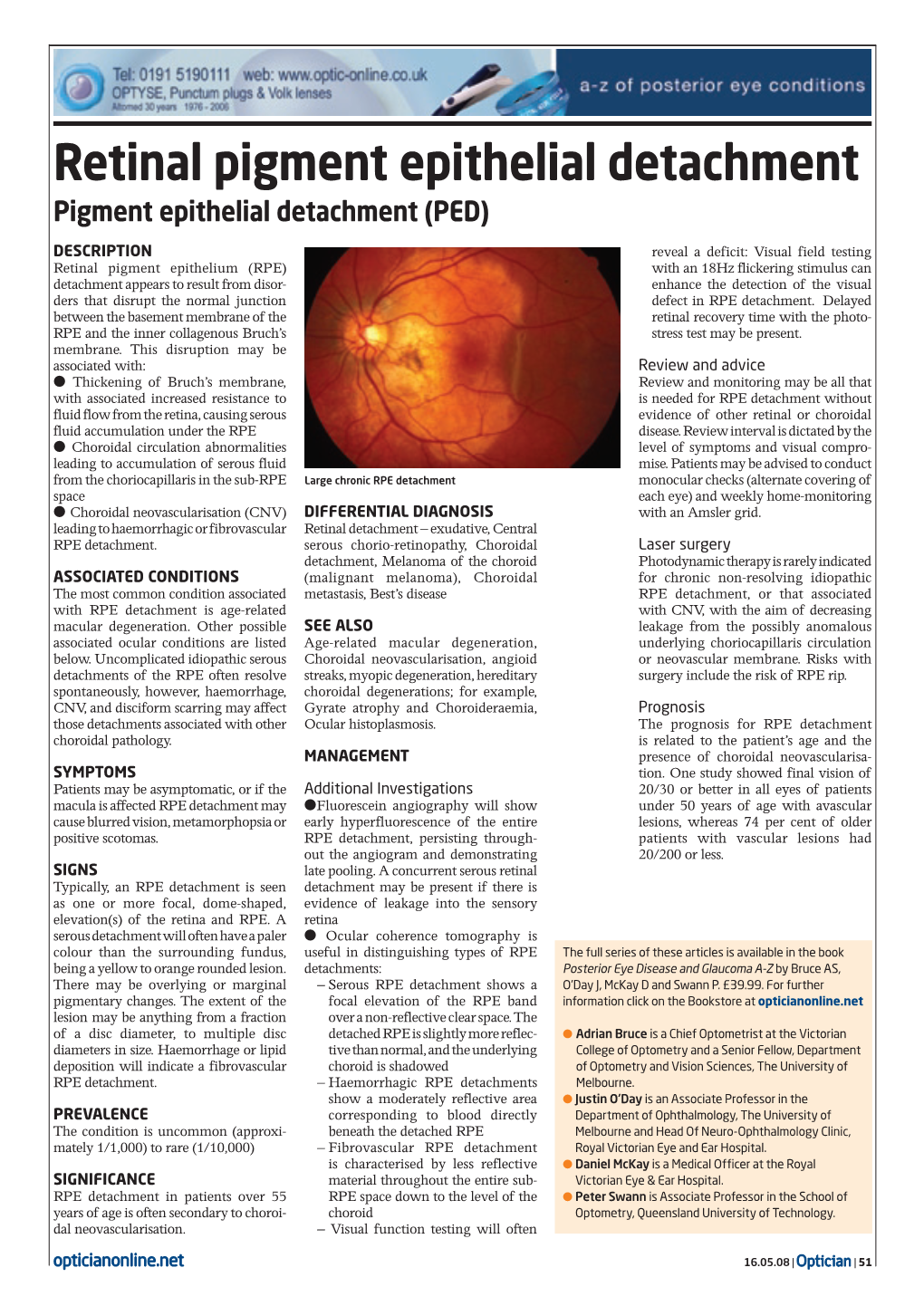 Retinal Pigment Epithelial Detachment Pigment Epithelial Detachment (PED)