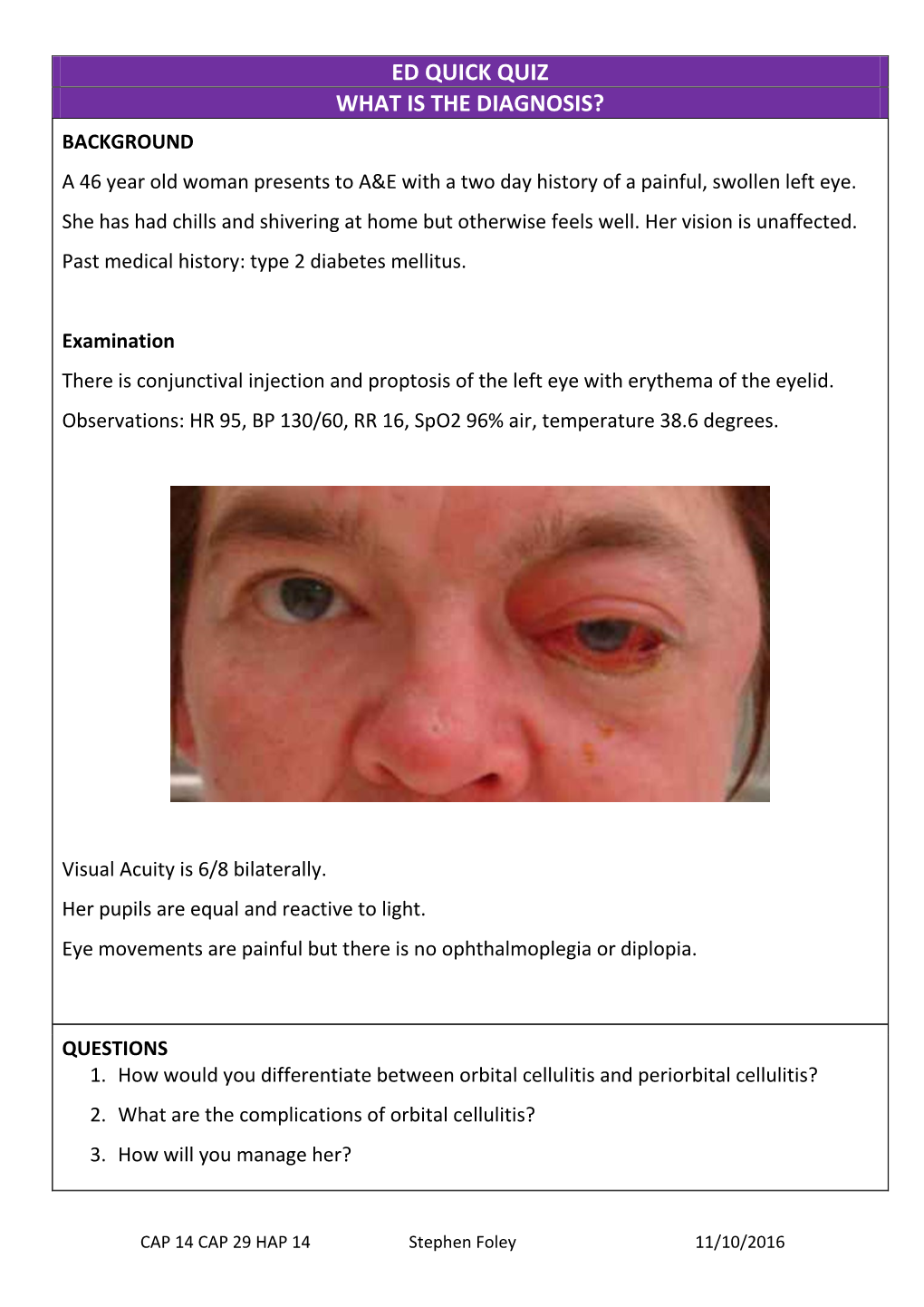 ED QUICK QUIZ WHAT IS the DIAGNOSIS? BACKGROUND a 46 Year Old Woman Presents to A&E with a Two Day History of a Painful, Swollen Left Eye