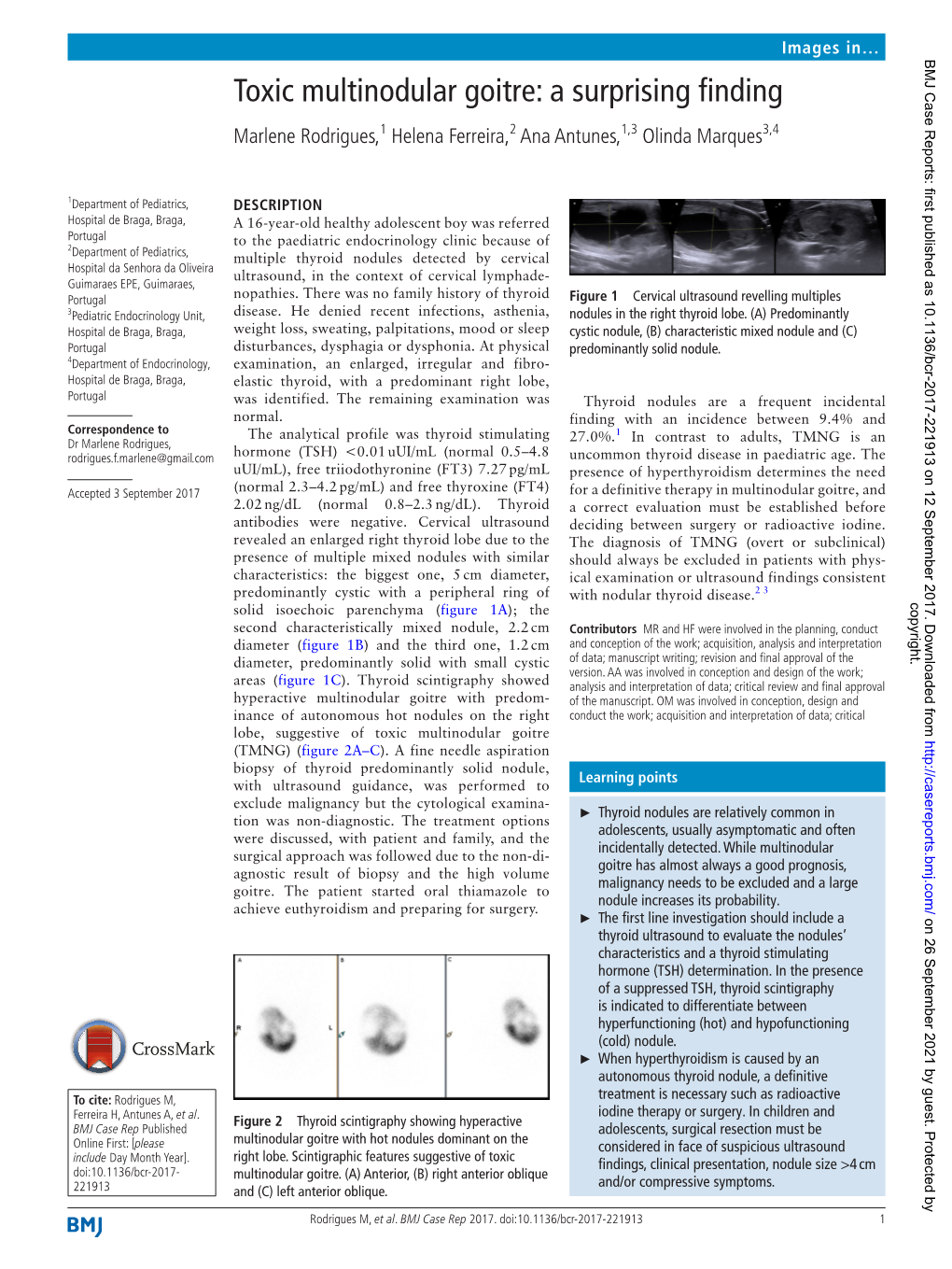 Toxic Multinodular Goitre: a Surprising Finding Marlene Rodrigues,1 Helena Ferreira,2 Ana Antunes,1,3 Olinda Marques3,4