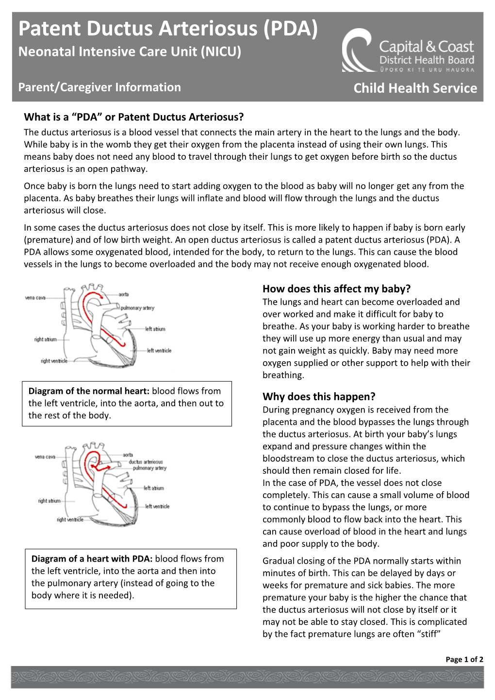 Patent Ductus Arteriosus (PDA) Neonatal Intensive Care Unit (NICU)