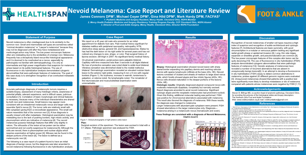Nevoid Melanoma: Case Report and Literature Review James Connors DPM1, Michael Coyer DPM1, Gina Hild DPM2, Mark Hardy DPM, FACFAS3 1