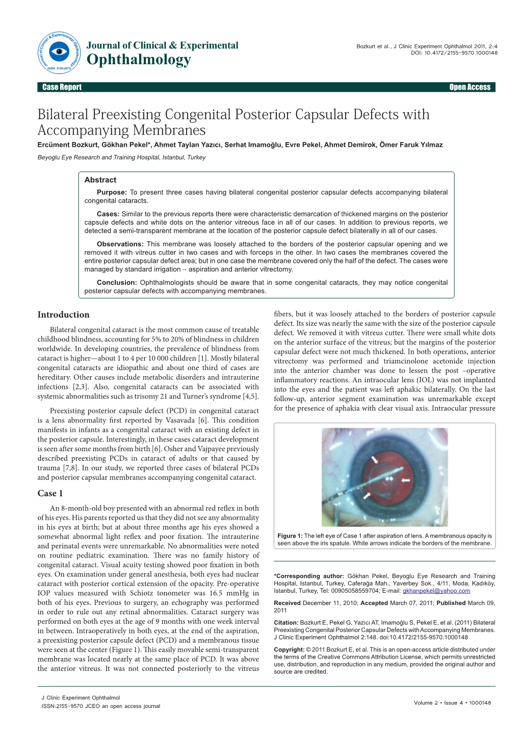 Bilateral Preexisting Congenital Posterior Capsular Defects