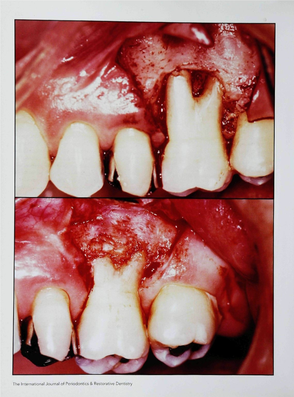 The International Journal of Periodontics & Restorative Dentistry