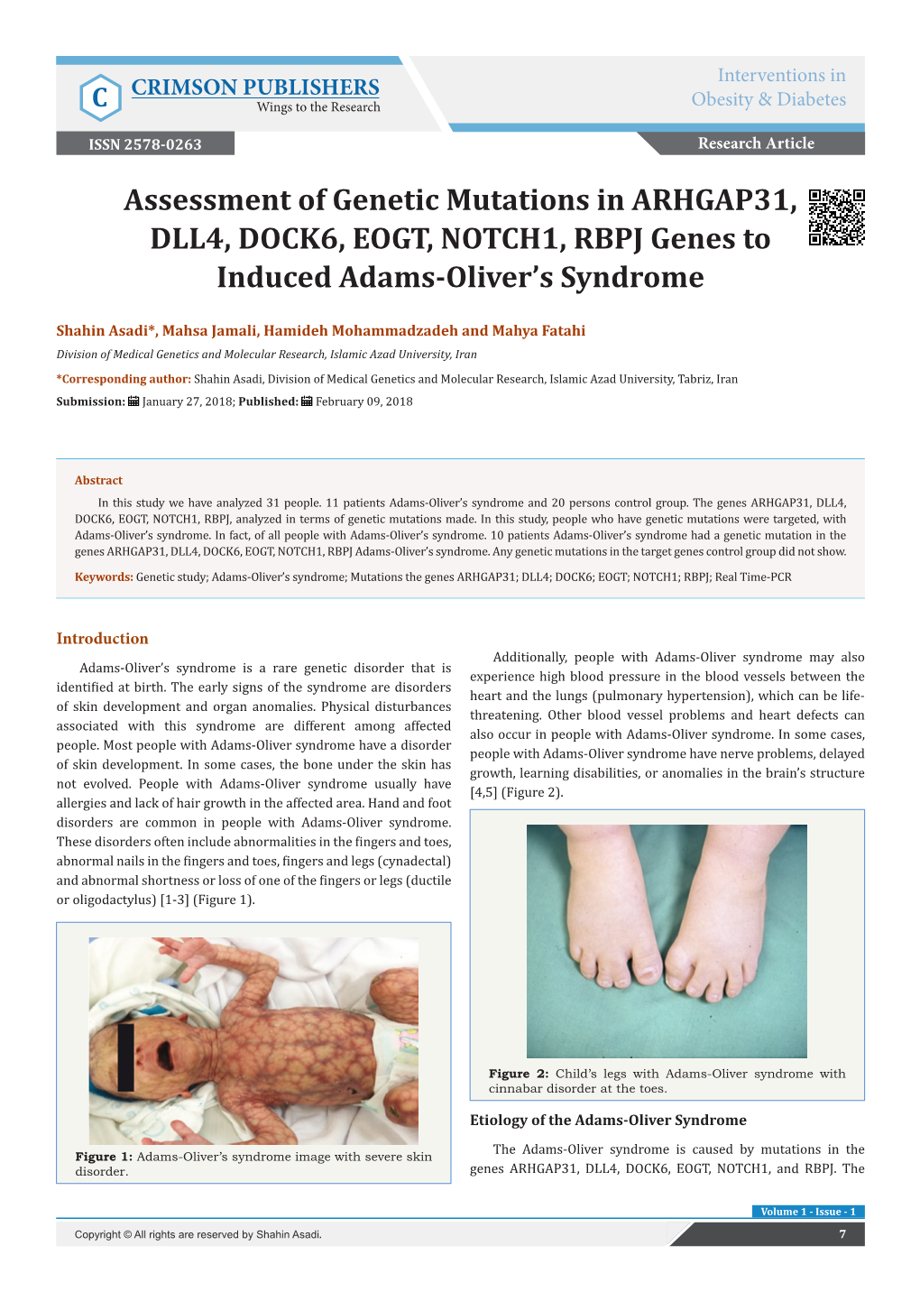 Assessment of Genetic Mutations in ARHGAP31, DLL4, DOCK6, EOGT, NOTCH1, RBPJ Genes to Induced Adams-Oliver’S Syndrome