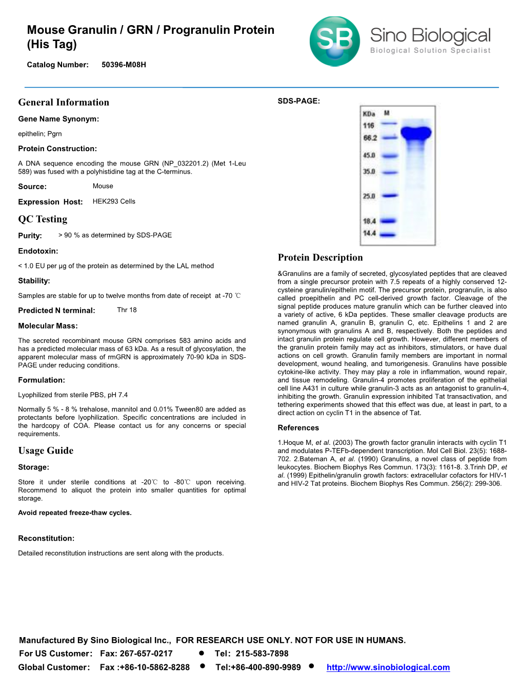 Mouse Granulin / GRN / Progranulin Protein (His Tag)