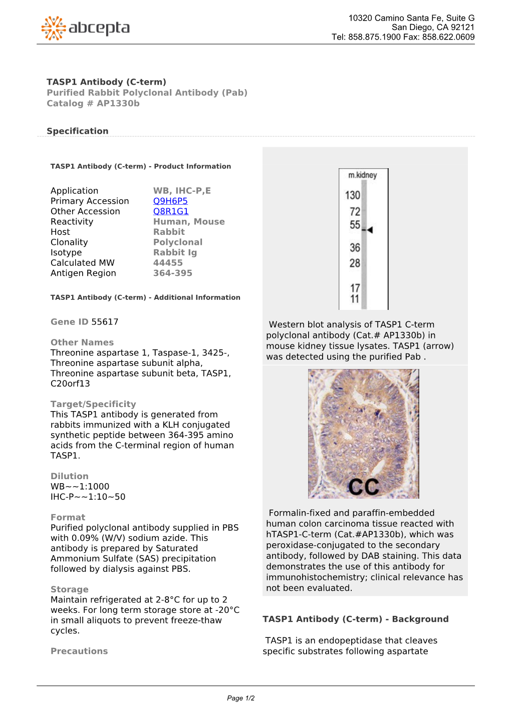 TASP1 Antibody (C-Term) Purified Rabbit Polyclonal Antibody (Pab) Catalog # Ap1330b