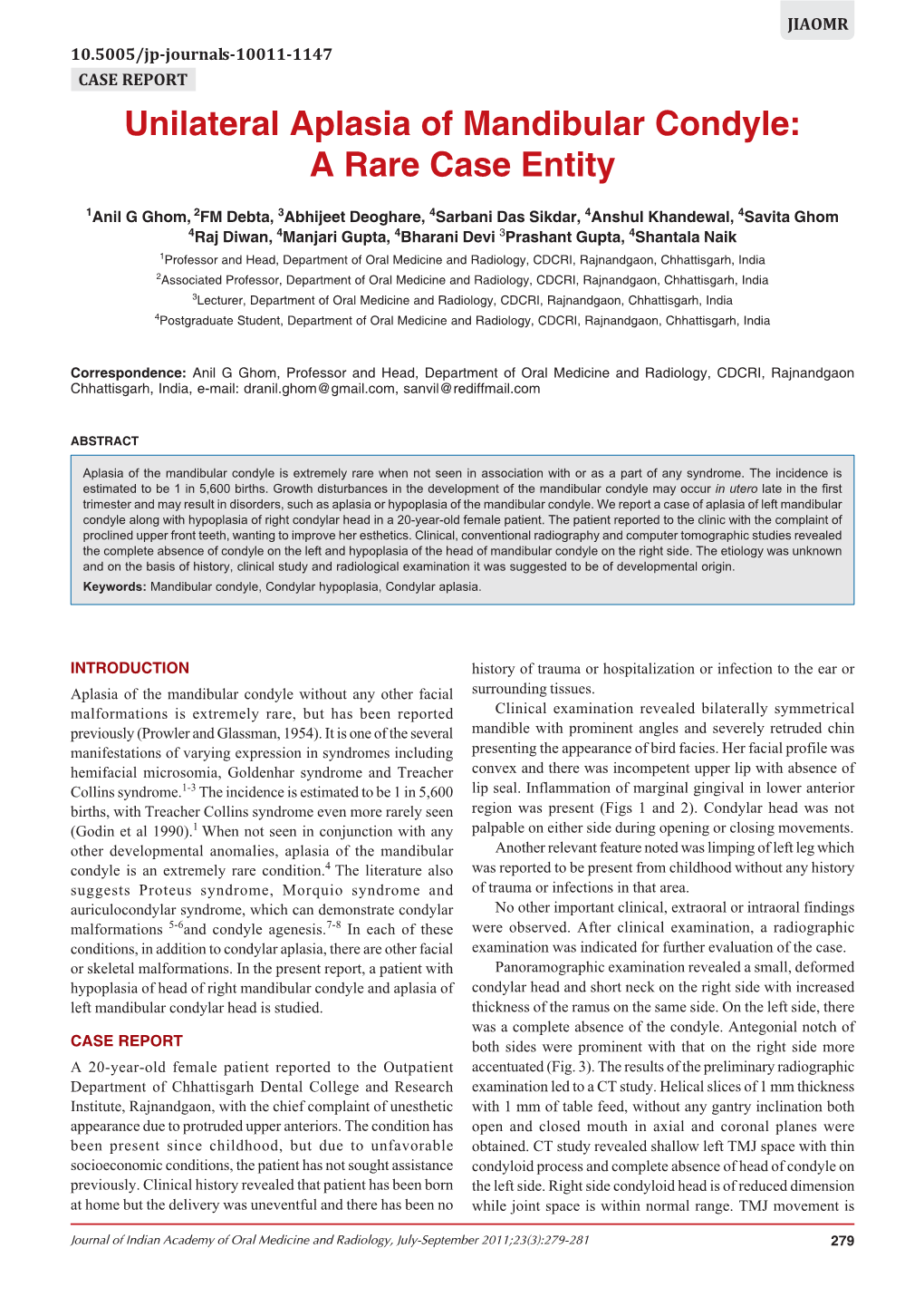 Unilateral Aplasia of Mandibular Condyle: a Rare Case Entity Unilateral Aplasia of Mandibular Condyle: a Rare Case Entity