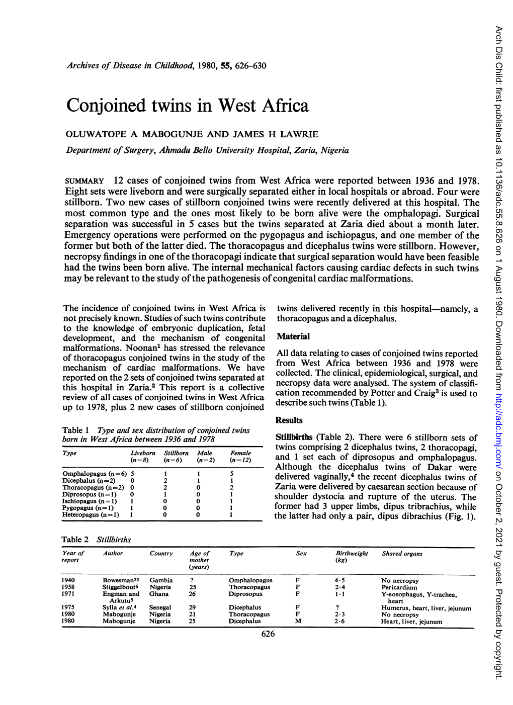 Conjoined Twins in West Africa