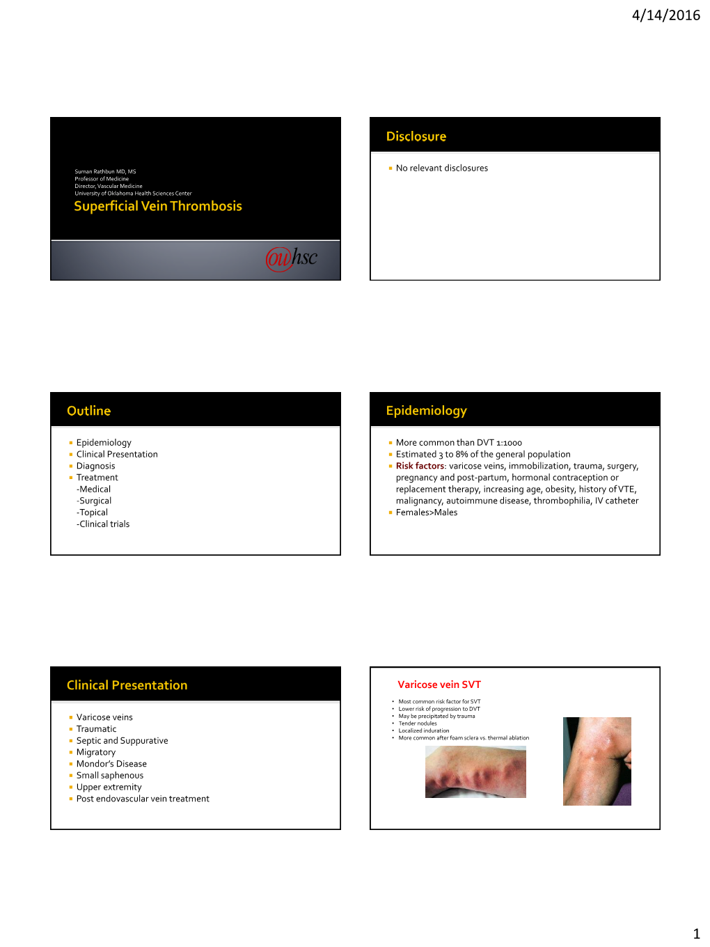 Treatment of Superficial Vein Thrombosis: Role of Anticoagulation