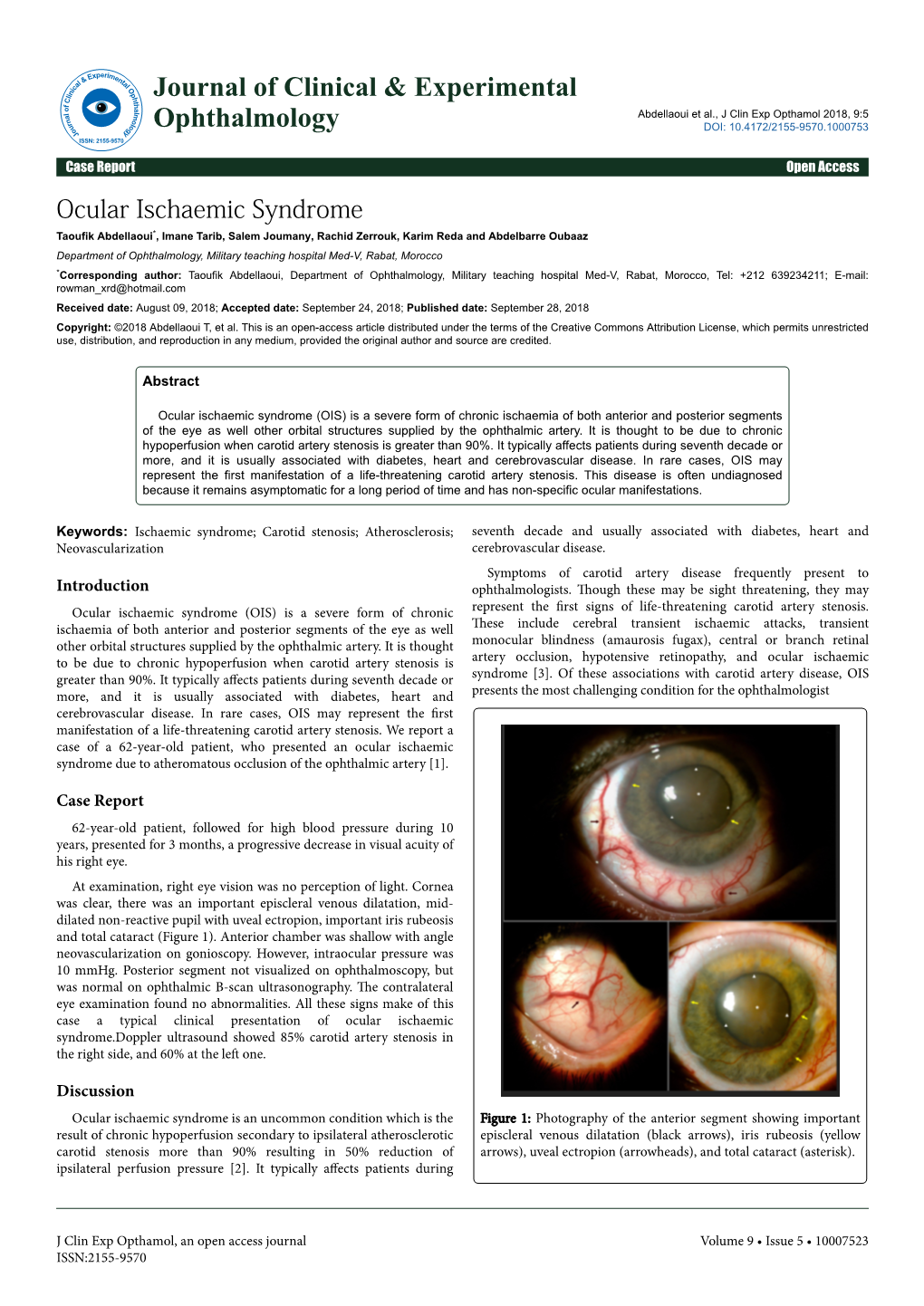 Ocular Ischaemic Syndrome