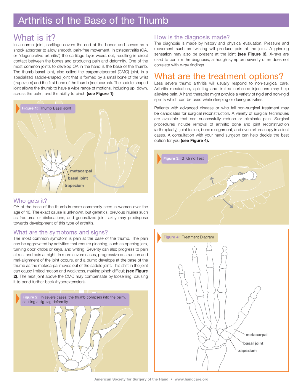 Arthritis of the Base of the Thumb