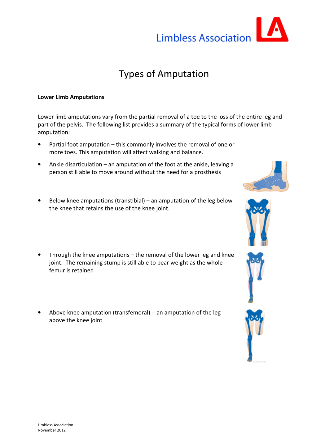 Types of Amputation