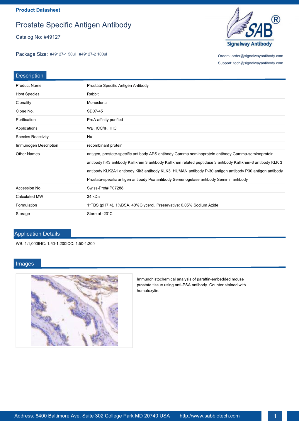 Prostate Specific Antigen Antibody