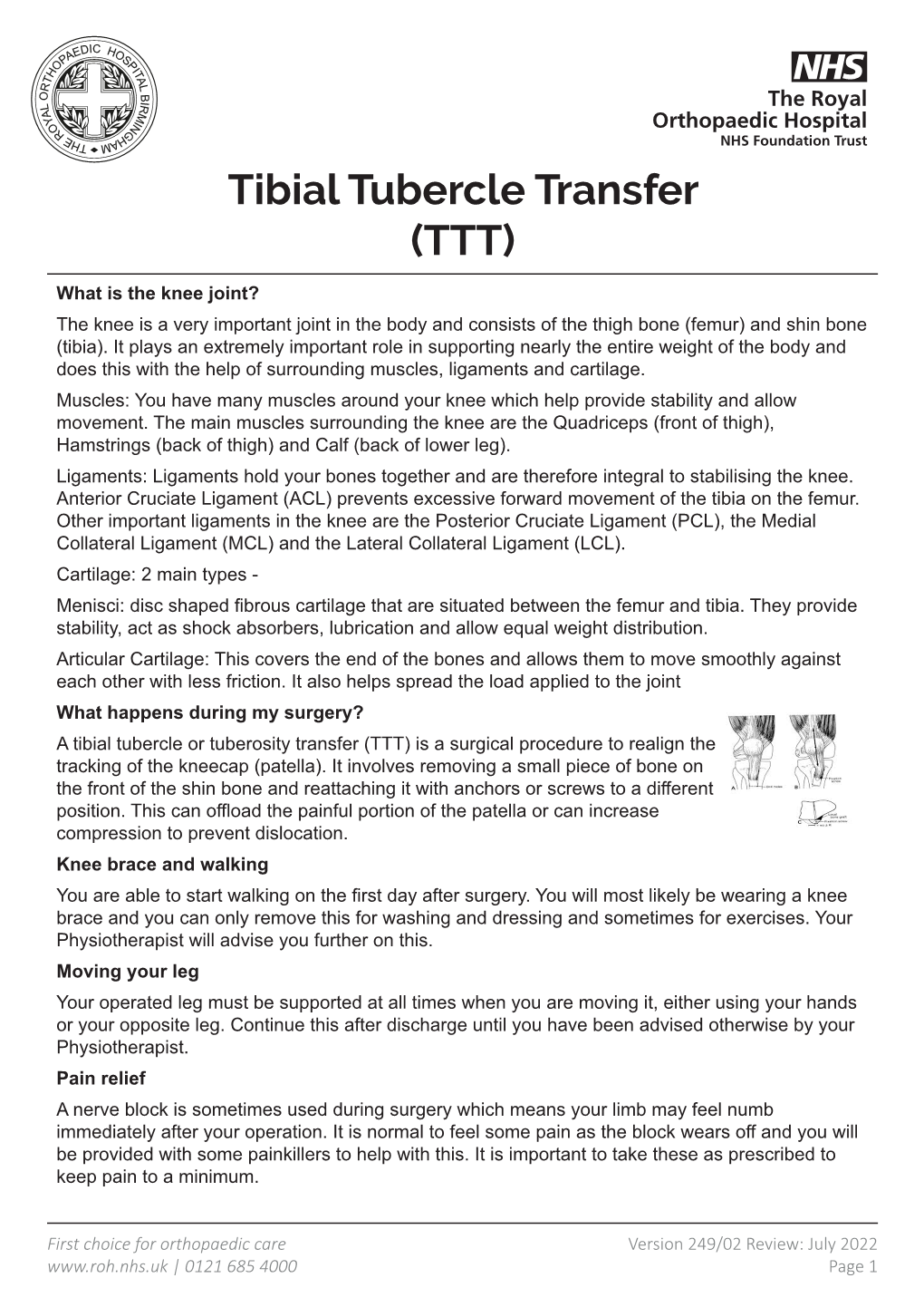 Tibial Tubercle Transfer (TTT)