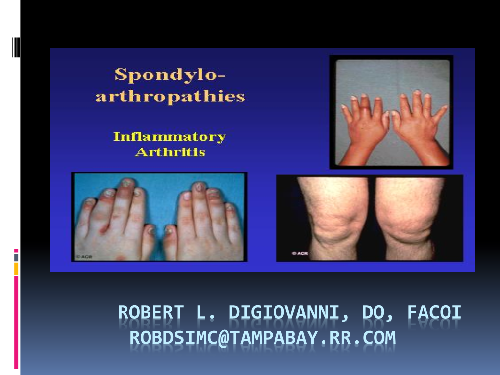 Seronegative Spondyloarthropathies