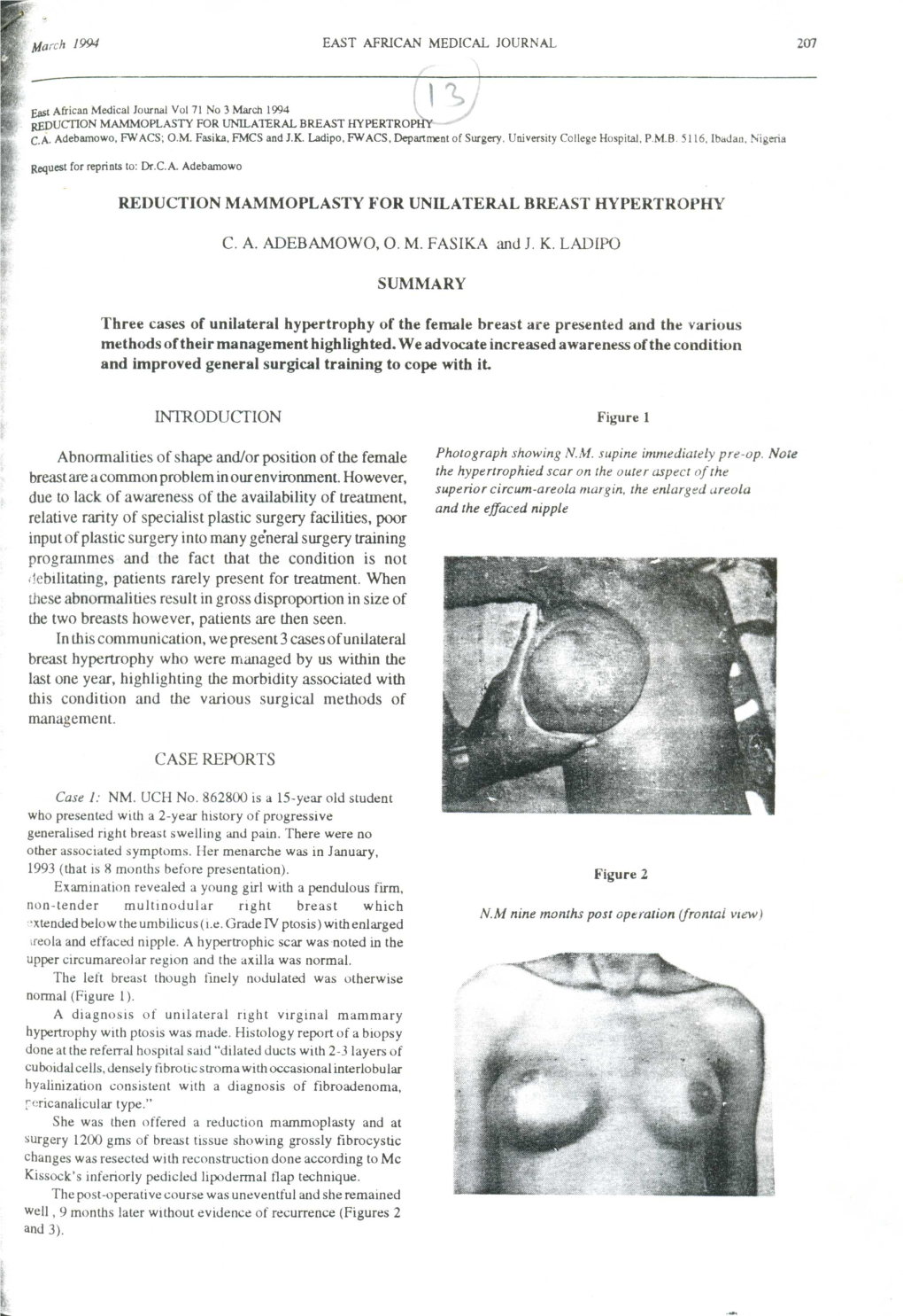 Iniroducfion Three Cases of Unilateral Hypertrophy of the Female