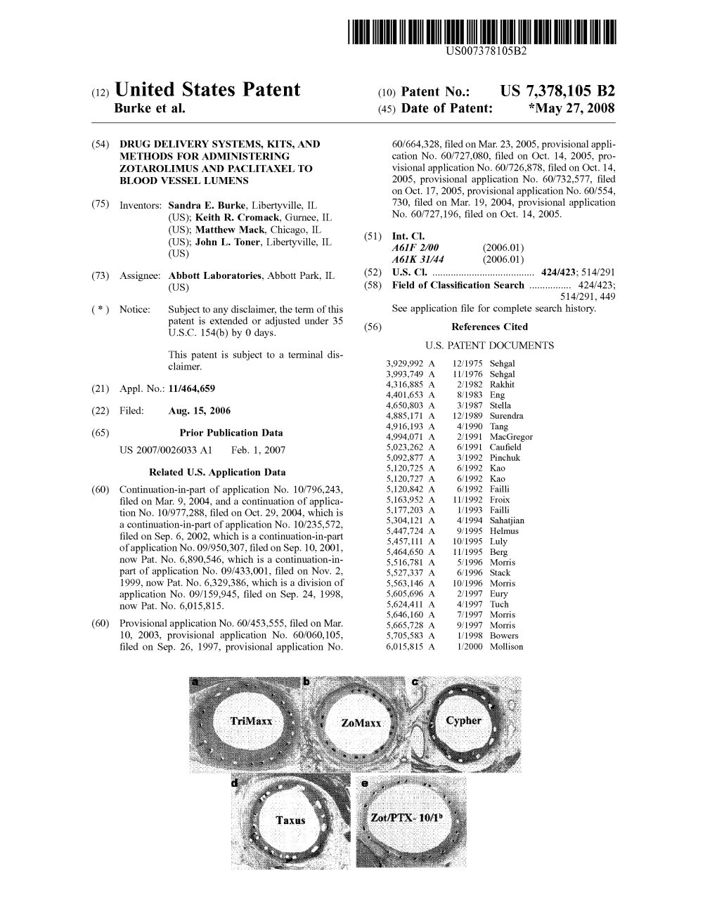 (12) United States Patent (10) Patent No.: US 7,378,105 B2 Burke Et Al