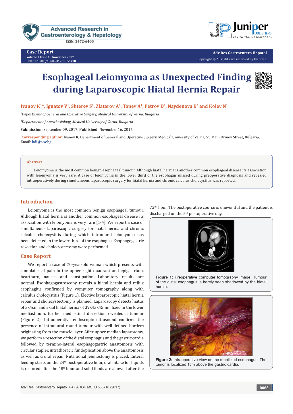 Esophageal Leiomyoma As Unexpected Finding During Laparoscopic Hiatal Hernia Repair