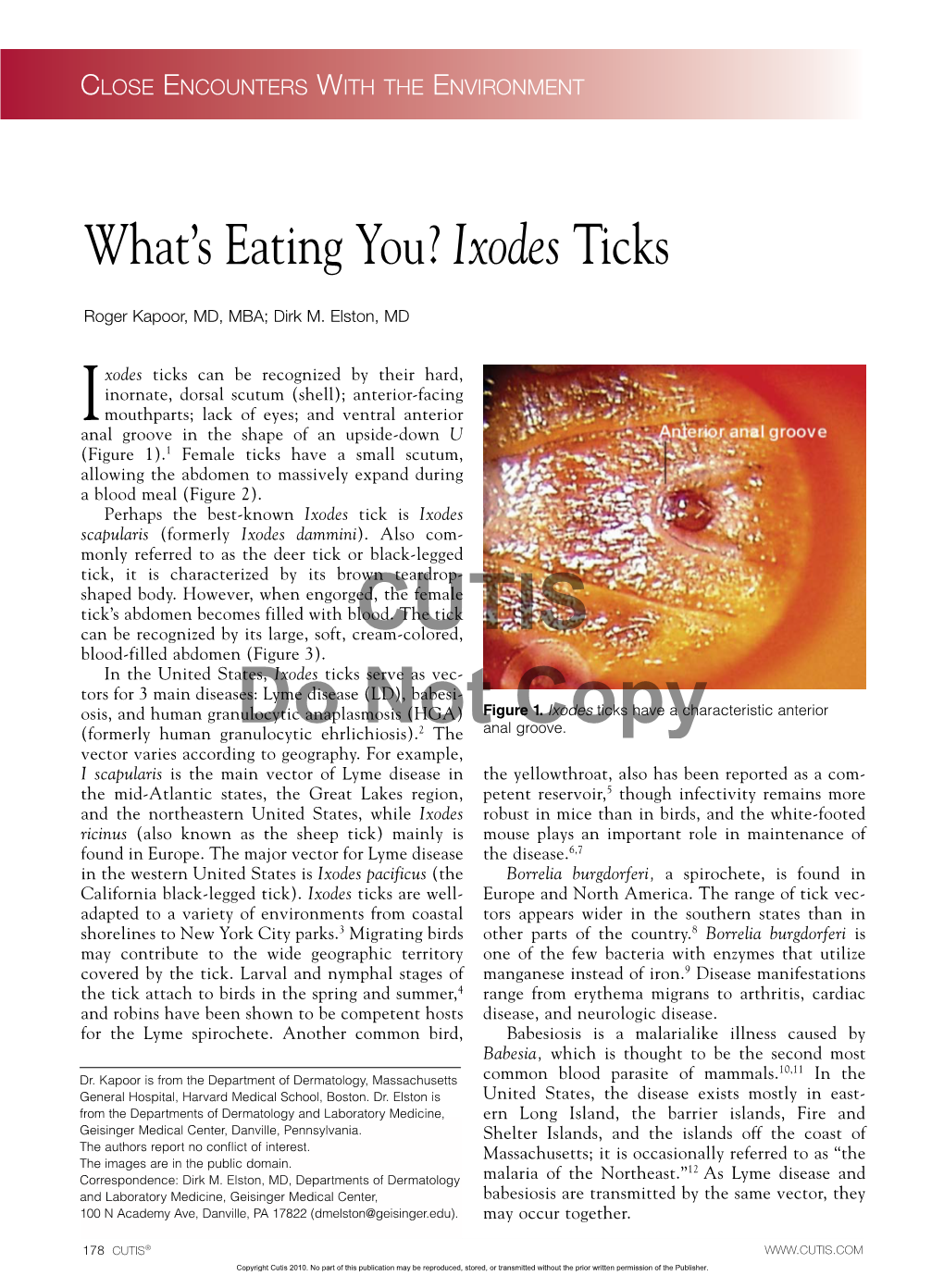 What's Eating You? Ixodes Ticks
