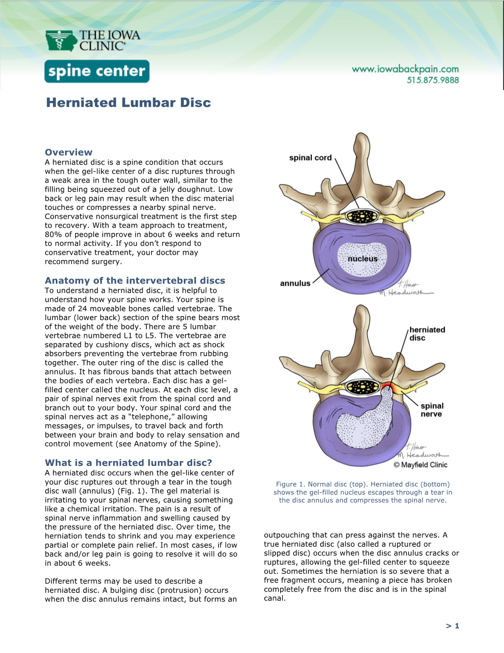 Herniated Lumbar Disc.Pdf