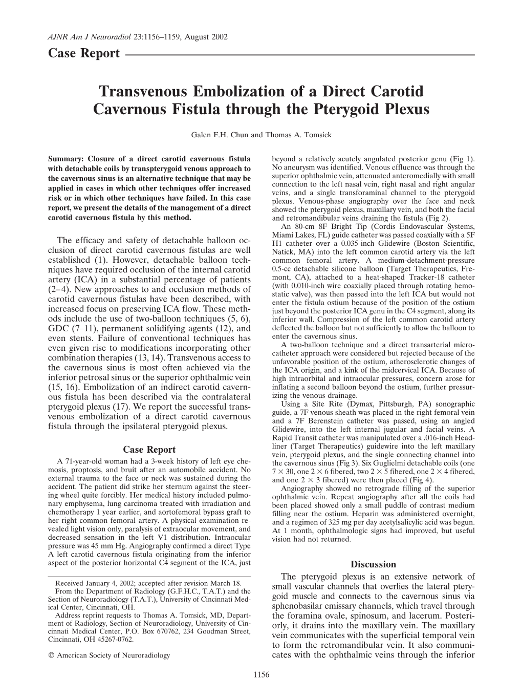 Transvenous Embolization of a Direct Carotid Cavernous Fistula Through the Pterygoid Plexus