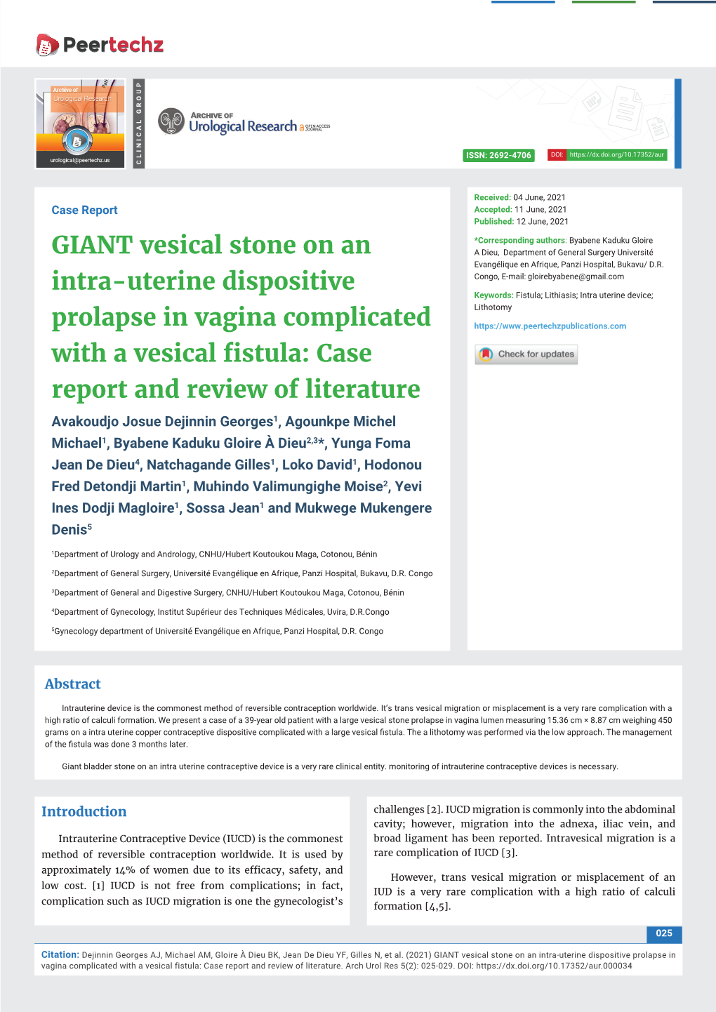 GIANT Vesical Stone on an Intra-Uterine Dispositive Prolapse in Vagina Complicated with a Vesical Fistula: Case Report and Review of Literature