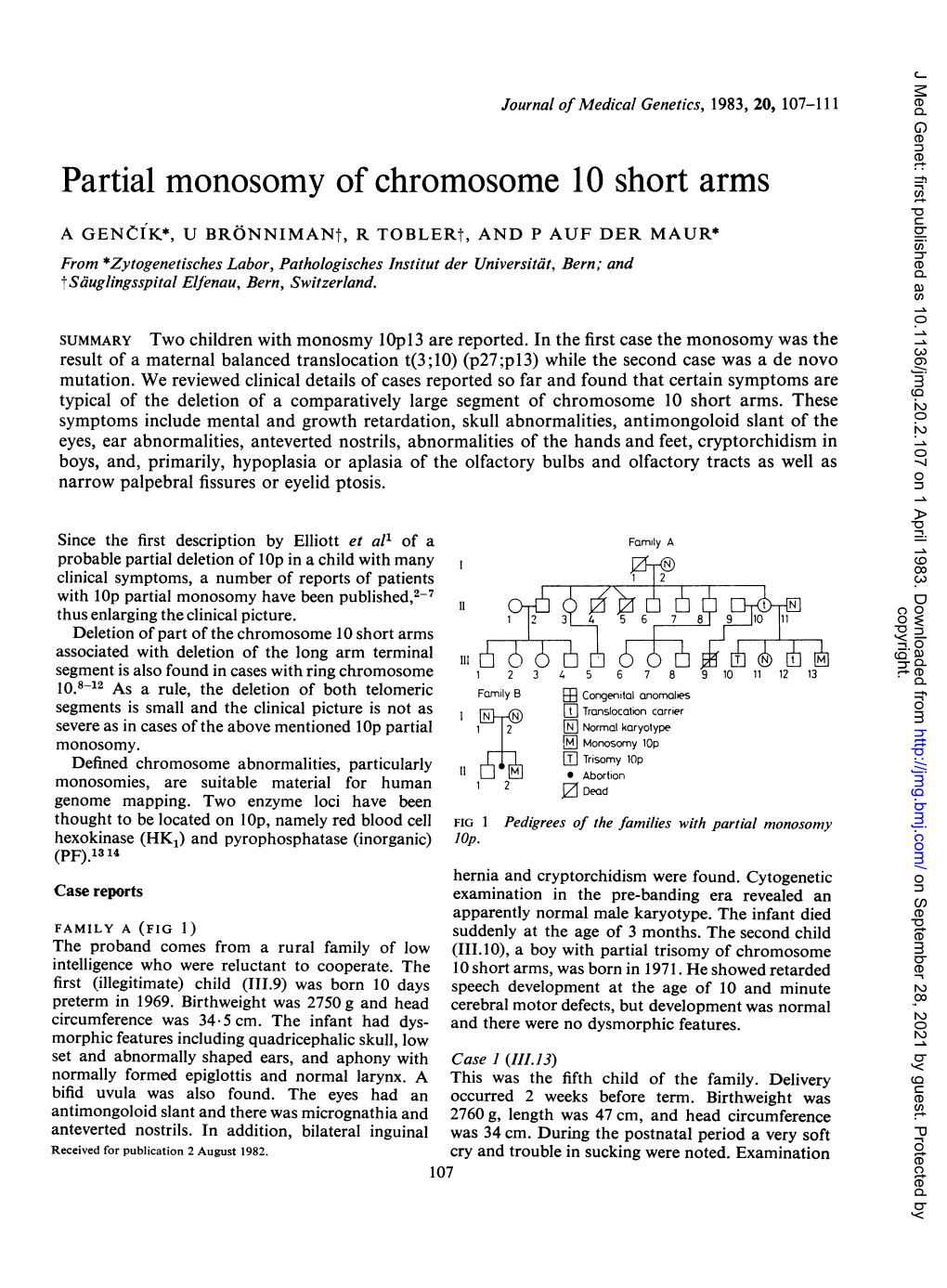 Partial Monosomy of Chromosome 10 Short Arms