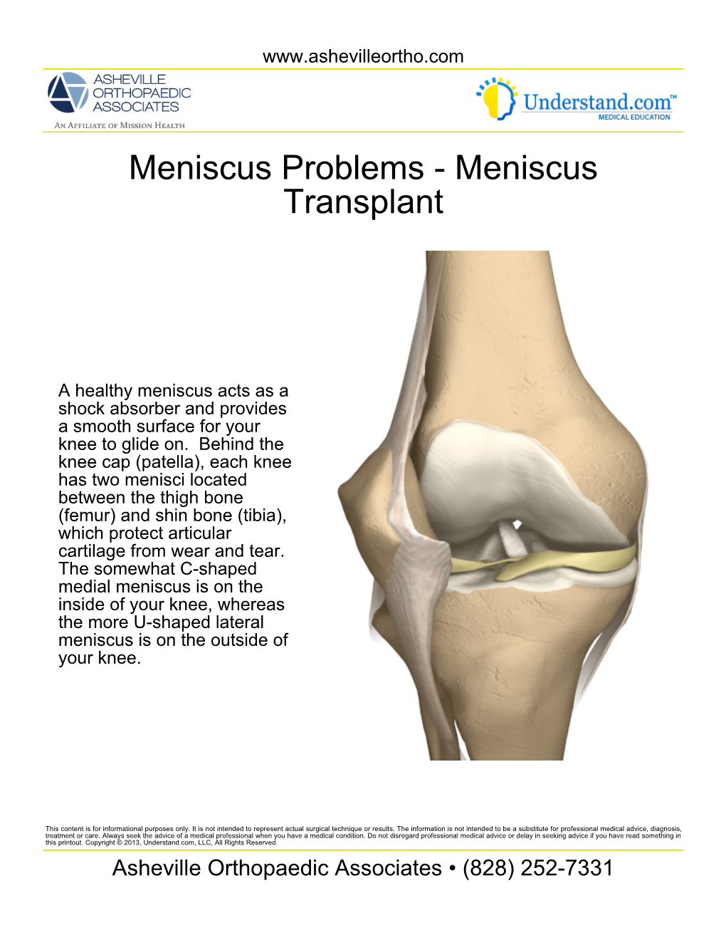 Meniscus Transplant