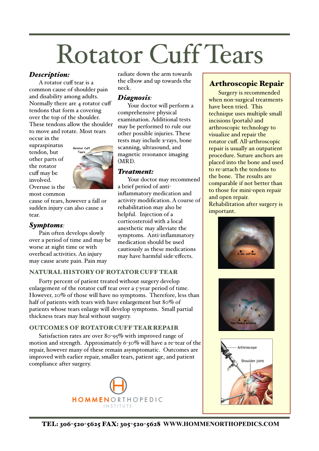 Rotator Cuff Tear