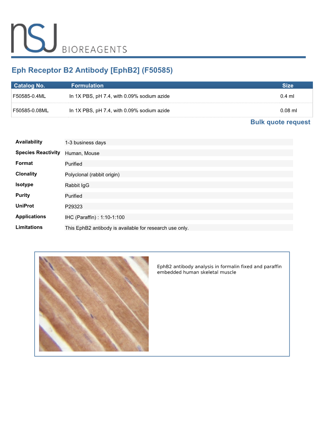 Eph Receptor B2 Antibody [Ephb2] (F50585)