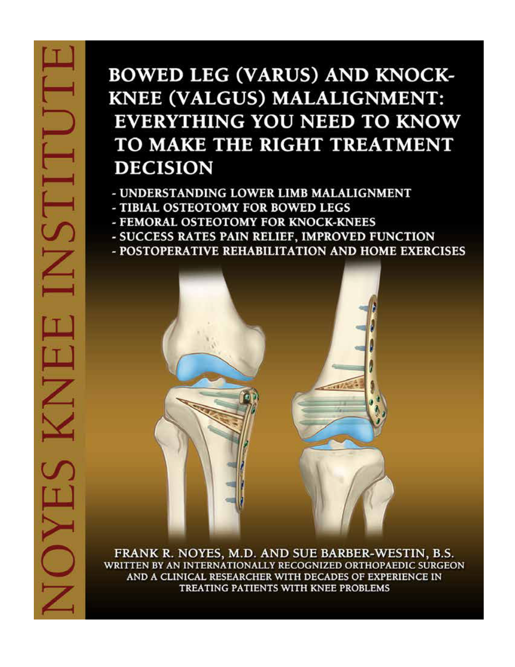 Osteotomy.Pdf