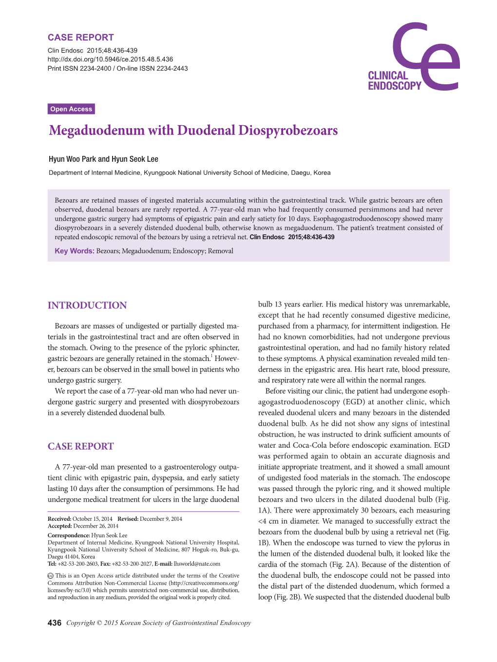 Megaduodenum with Duodenal Diospyrobezoars