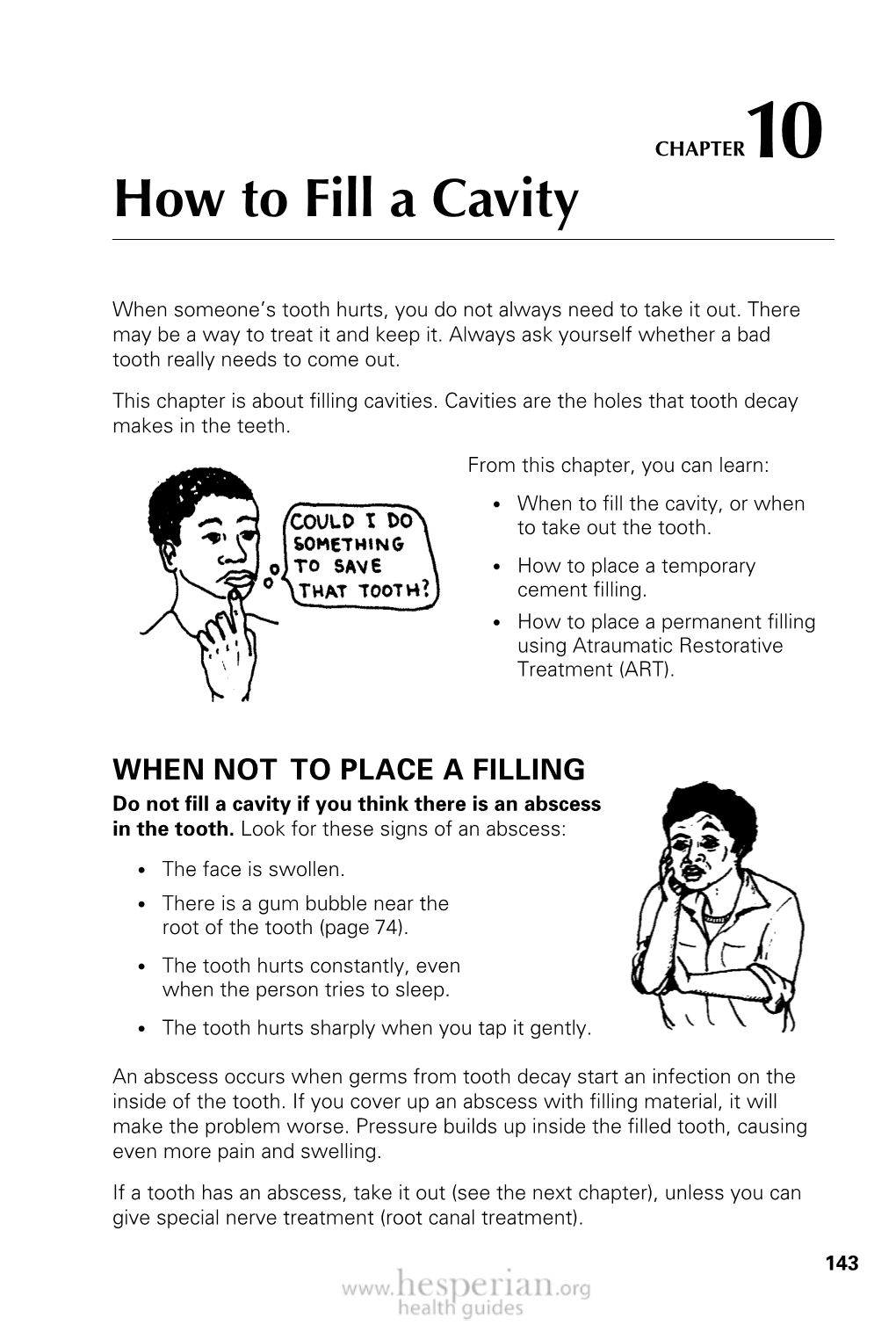 How to Fill a Cavity