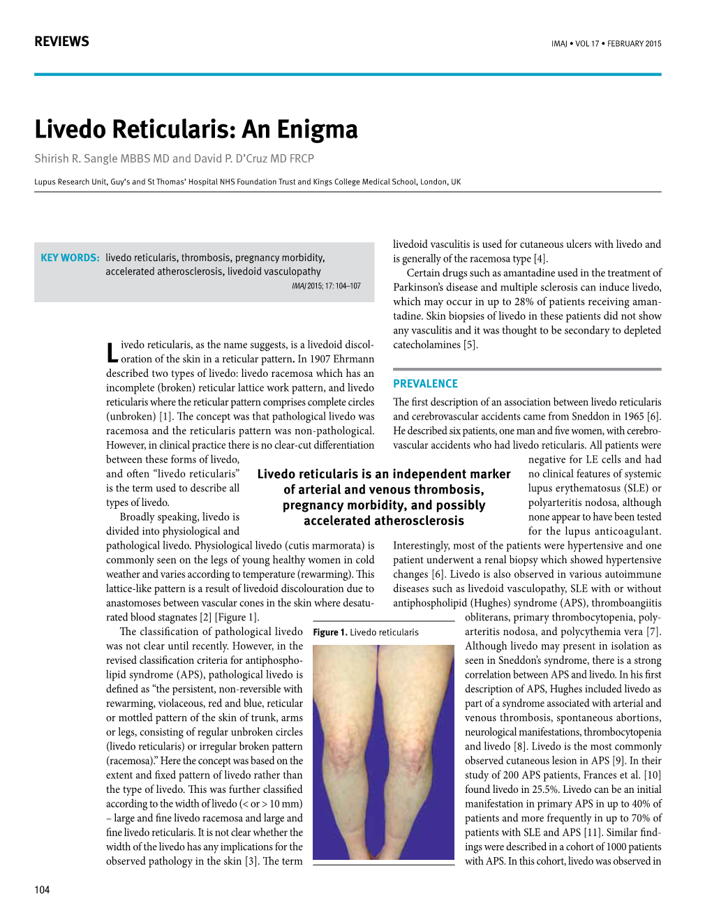 Livedo Reticularis: an Enigma Shirish R