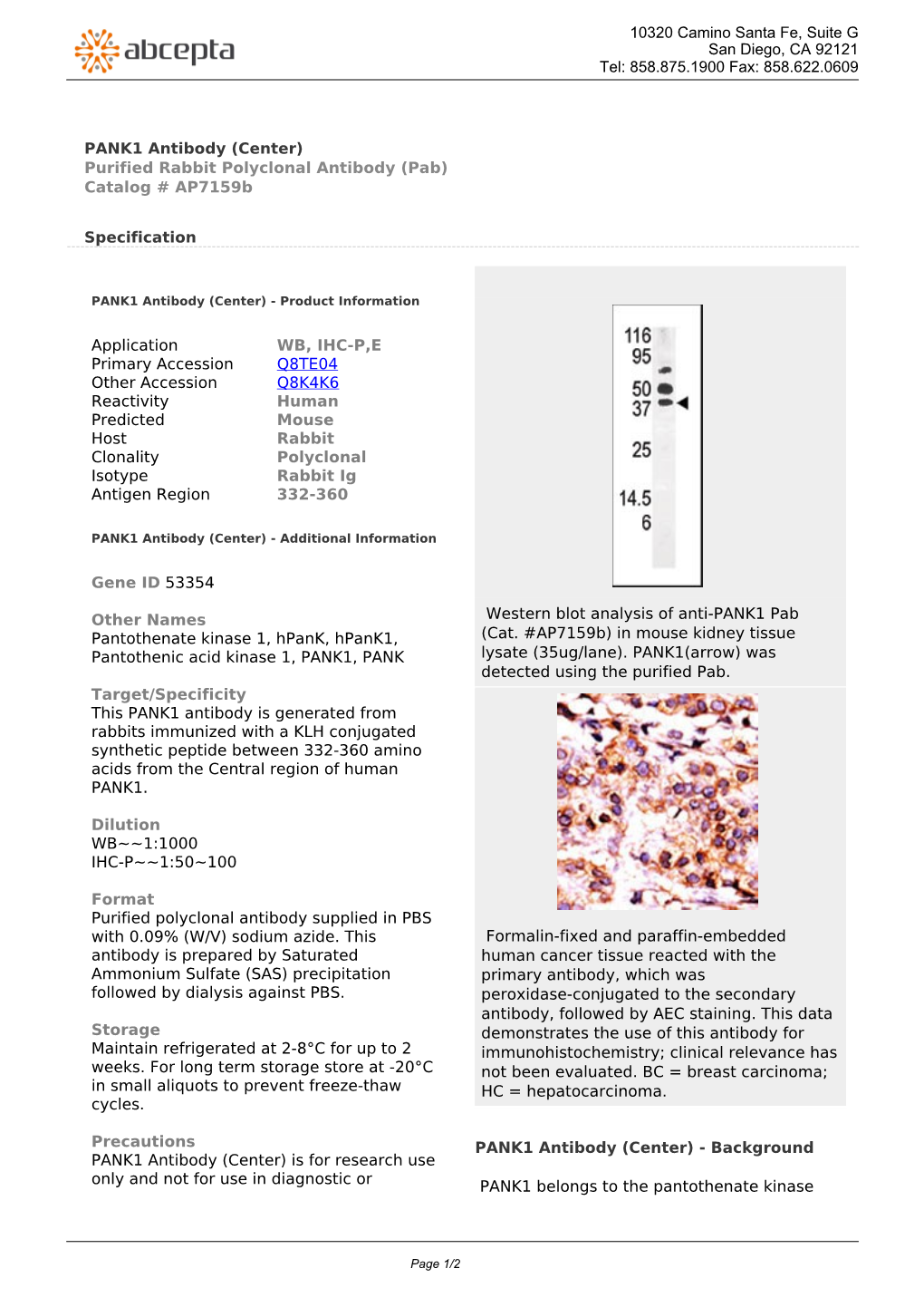 PANK1 Antibody (Center) Purified Rabbit Polyclonal Antibody (Pab) Catalog # Ap7159b