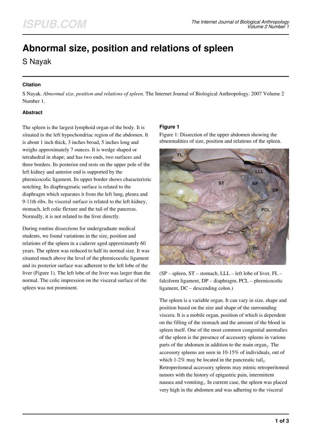 Abnormal Size, Position and Relations of Spleen S Nayak