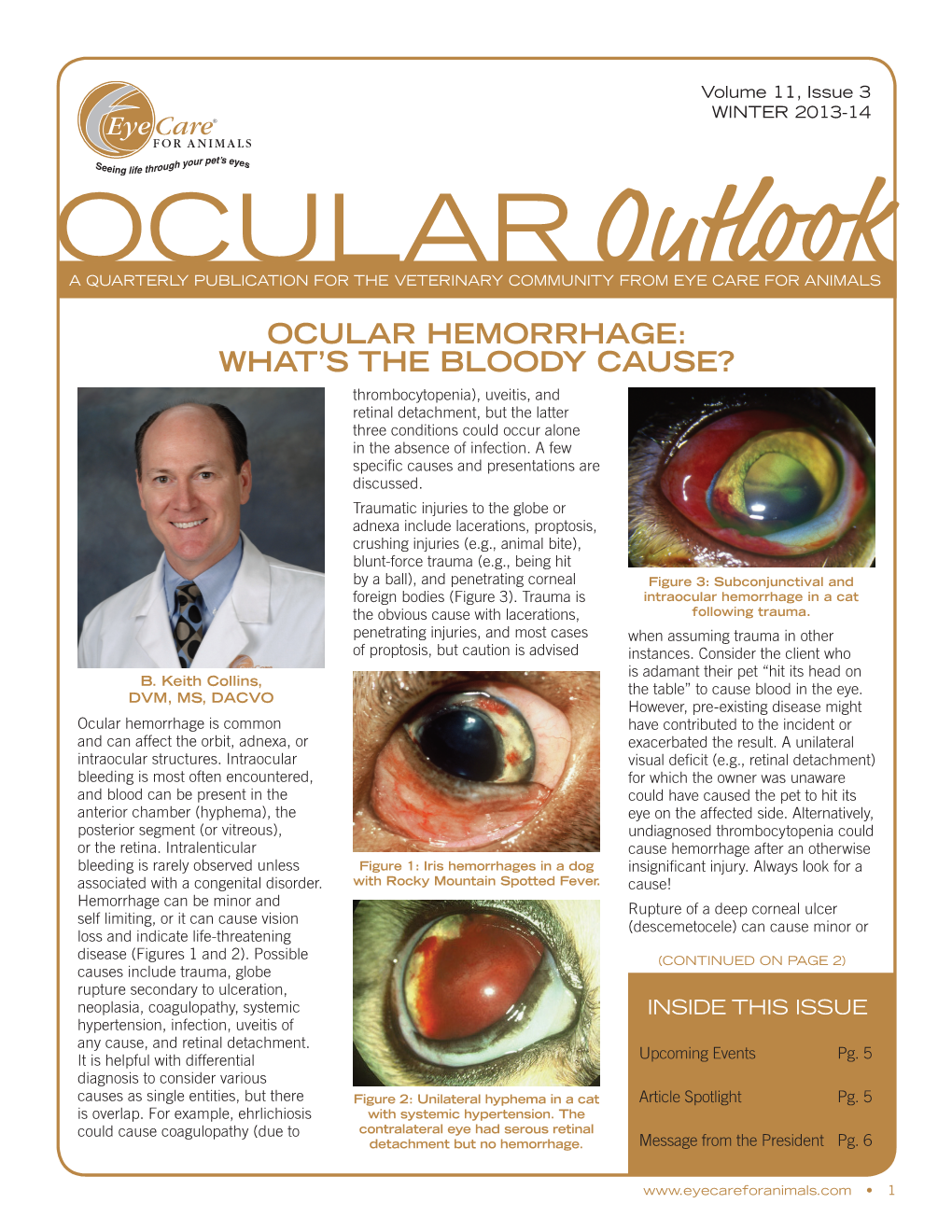 Ocular Hemorrhage