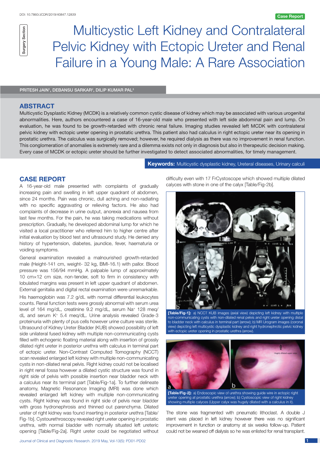 Multicystic Left Kidney and Contralateral Pelvic Kidney with Ectopic Ureter and Renal Surgery Section Failure in a Young Male: a Rare Association